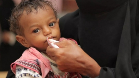 اليمن: ارتفاع حالات سوء التغذية الحاد بين الأطفال في الربع الأول من العام الجاري