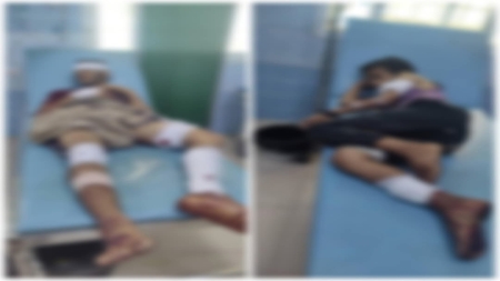 اليمن: إصابة شقيقين إثر انفجار لغم من مخلفات الحرب شرقي تعز