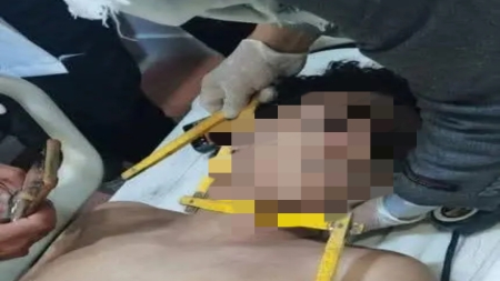 اليمن: وفاة فتى تحت التعذيب خلال جلسة “رقية شرعية” في إب