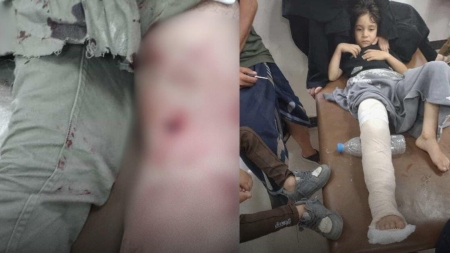 اليمن: إصابة شاب وطفل برصاص قناص في تعز