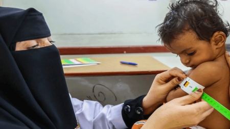 روما: "الغذاء العالمي" يُعلن حاجته إلى 802 مليون دولار لمكافحة الجوع في اليمن العام القادم