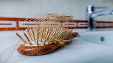 صحة: ارتباط بين تساقط الشعر وأمراض خطيرة