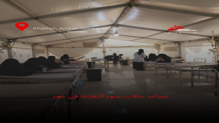 اليمن: زيادة حالات سوء التغذية الحاد لدى الأطفال في عمران بنسبة 48%