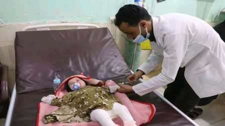 اليمن: 10 وفيات ونحو 1.5 ألف إصابة بالحصبة في مأرب منذ بداية العام