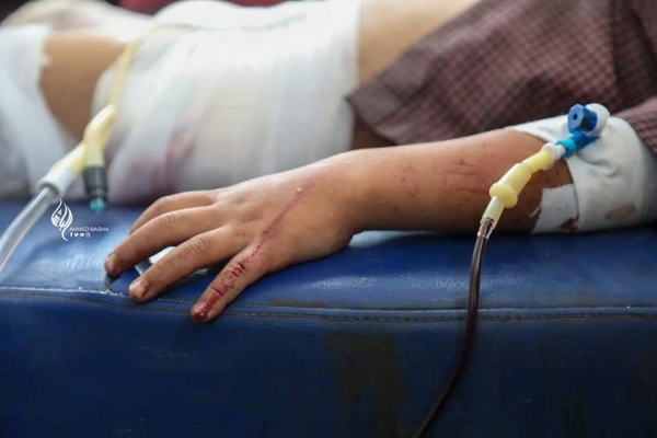 اليمن: مقتل ثلاثة اطفال في تعز واصابة اخرين في احدث انتهاك ضد المدنيين