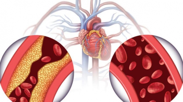 صحة: الخفض الفعال لضغط الدم يقلل حدوث مشكلات القلب