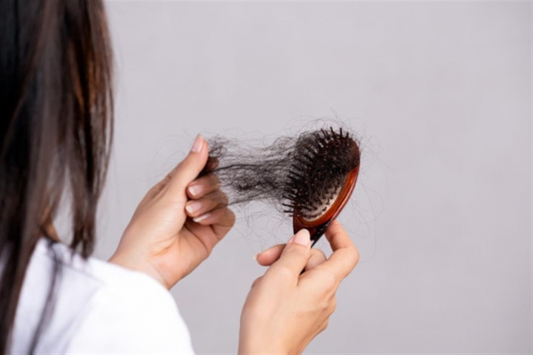 صحة: 5 عوامل رئيسية تسبب تساقط الشعر