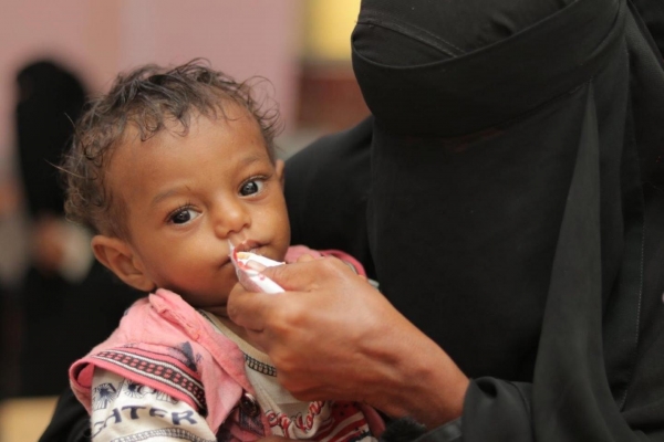 اليمن: الولايات المتحدة تقدم 4,8 مليون دولار لمعالجة سوء التغذية لدى الأطفال