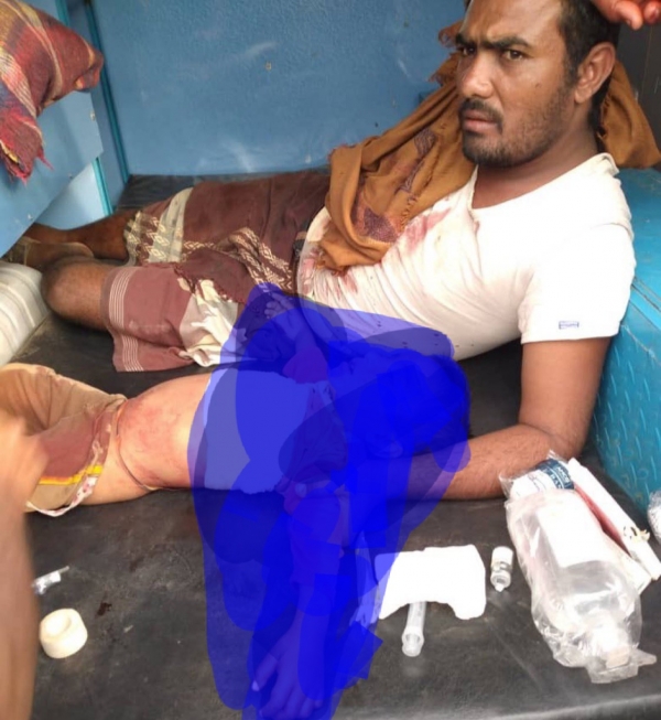 اليمن: مقتل طفل وإصابة والداه بقصف "حوثي" على منزلهم في الحديدة