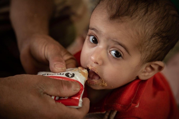 اليمن: الأمم المتحدة تخصص 18 مليون دولار لمنع المجاعة ومواجهة تفاقم انعدام الأمن الغذائي