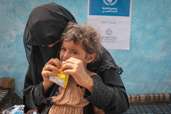 اليمن: توقف علاج حالات سوء التغذية لدى الأطفال في مناطق الحوثيين نهاية الشهر الجاري
