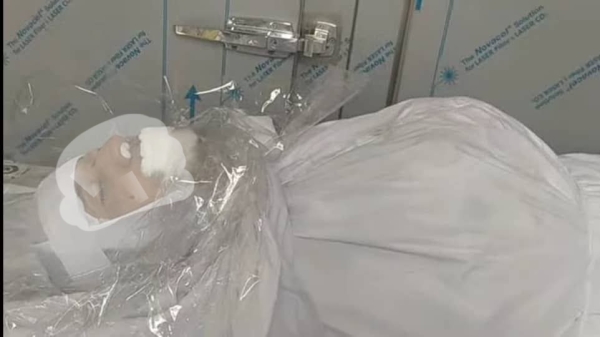 اليمن: مقتل مدني برصاص قناص في تعز