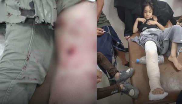 اليمن: إصابة شاب وطفل برصاص قناص في تعز