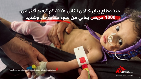 اليمن: ارتفاع معدلات سوء التغذية الحاد في عمران وأكثر من ألف حالة منذ بداية العام