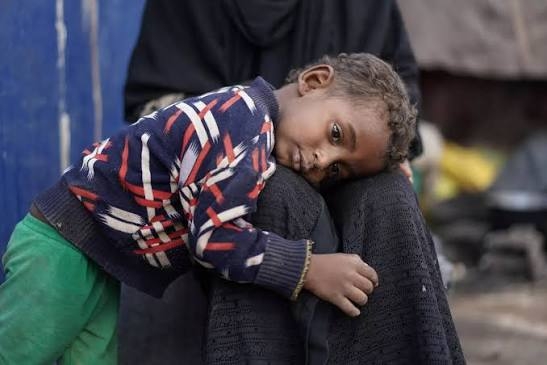 نيويورك: 45 منظمة إنسانية تدعو لتحرك دولي عاجل لمنع انزلاق ملايين اليمنيين إلى المجاعة