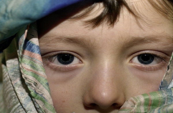 صحة: ليست بسبب السهر فقط.. ألوان الهالات تحت العينين تكشف أمراضا داخلية