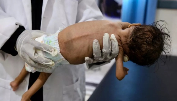 تقرير: أكثر من نصف سكان اليمن مهددون بانعدام الأمن الغذائي