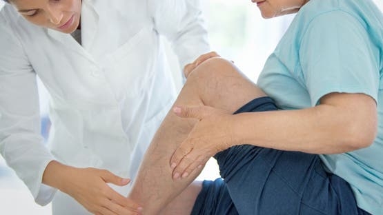 صحة: دوالي الساقين.. النساء أكثر إصابة وهذه علامات الخطر