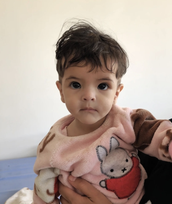 اليمن: إصابة أكثر من 5 آلاف طفل بسوء التغذية في البيضاء خلال خمسة أشهر