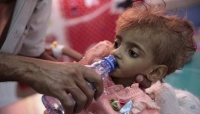 تليجراف: طفل يمني يموت كل 70 ثانية