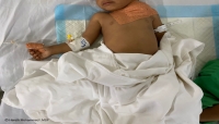 اليمن: مقتل طفل واصابة ثلاثة اخرين وأمهم بقصف منسوب للحوثيين على حيس