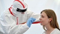 كورونا حول العالم ي‏تسبب الفيروس بوفاة 3,294,812 شخصا