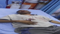 اليمن: نقابة الصحفيين تدين الاعتداء على الصحفي العزيزي بصنعاء وتستنكر موقف السلطات