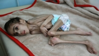 أوكسفام: 11 شخصاً يموتون جوعاً كل دقيقة حول العالم واليمن إحدى أسوأ بقع الجوع الساخنة