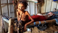 رويترز: اليمن ثاني أكبر أزمة غذائية في العالم
