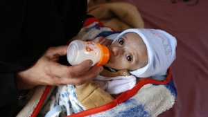 رويترز: 7.6 مليون يمني بحاجة للعلاج من سوء التغذية