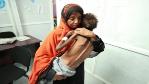 روما: الصومال واليمن في صدارة الشعوب العربية جوعا