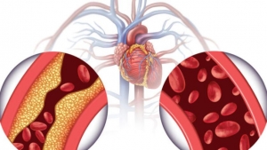 صحة: الخفض الفعال لضغط الدم يقلل حدوث مشكلات القلب