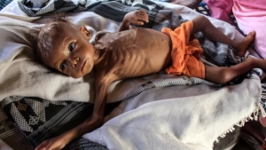 بي بي سي: هل تزيد تداعيات حرب أوكرانيا من احتمالات المجاعة في اليمن؟
