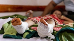 اليمن: مقتل وإصابة أكثر من 113 طفل منذ بدء الهدنة الأممية