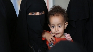 اليمن: الحربُ والفقر وجهان لمعاناةٍ واحدة