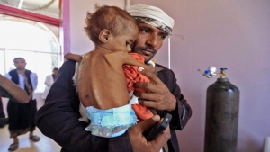 اليمن: "الغذاء العالمي" يقول إن مستويات انعدام الأمن الغذائي لا تزال مرتفعة