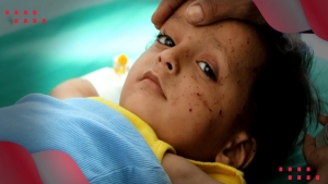 اليمن: أطفال تعز.. بين الموت والإعاقة الدائمة
