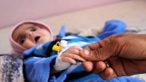 اليمن: 17 مليون شخص معرضون لمستويات عالية من انعدام الأمن الغذائي نهاية العام الجاري