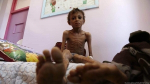 نيويورك: اليمن خامس البلدان الأكثر عرضة لتدهور الأزمات الإنسانية عام 2023