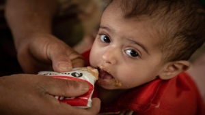 واشنطن: شبكة دولية تحذر من أن 60 بالمائة من اليمنيين سيعانون من انعدام الأمن الغذائي الحاد في العام المقبل