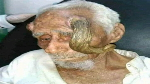 اليمن: وفاة المعمر اليمني "ذو القرنين" عن عمر بلغ 140 عاماً