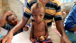 نيويورك: "الإنقاذ الدولية" تدعو الأمم المتحدة إلى إعطاء الأولوية للبلدان الأكثر عرضة لخطر المجاعة