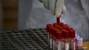 صحة: اختبار دم قد يكشف 50 نوعا من السرطان
