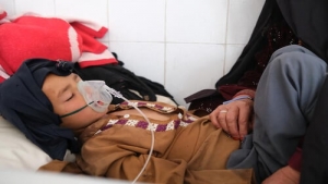 اليمن: ارتفاع كبير لحالات الإصابة بالحصبة بين الأطفال في محافظة حجة