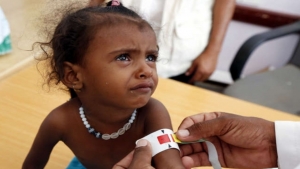 اليمن: "الغذاء العالمي" يعلق تدخلات الوقاية من سوء التغذية بداية من أغسطس القادم