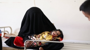 اليمن: ارتفاع حالات سوء التغذية بين الأطفال بمحافظة عمران بنسبة 60% العام الجاري