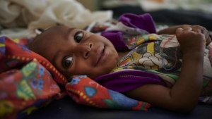 اليمن: تسجيل قرابة 15 ألف حالة سوء تغذية في مأرب خلال النصف الأول من العام الجاري