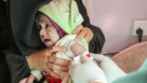 اليمن: تقرير أممي يحذر من ارتفاع حالات سوء التغذية الحاد خلال النصف الثاني من العام الجاري