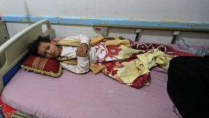 اليمن: أكثر من 28 ألف حالة إصابة بالحصبة في النصف الأول من العام الجاري