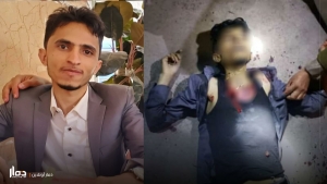 اليمن: مقتل طالب طب في حرم مستشفى حكومي بمحافظة ذمار